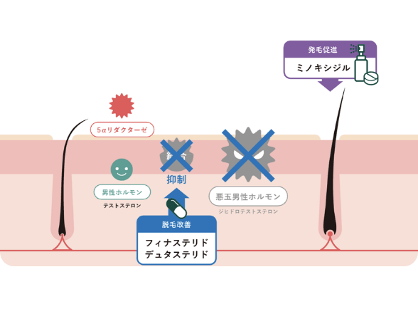 毛根イメージ