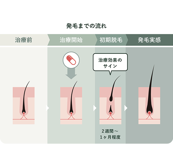 毛根イメージ